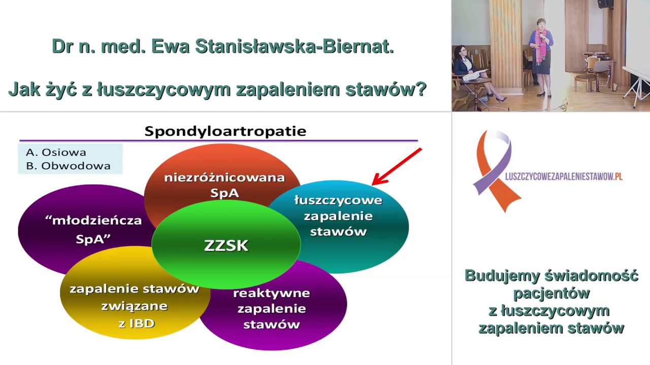 Jak żyć z łuszczycowym zapaleniem stawów? - Dr n. med. Ewa Biernat