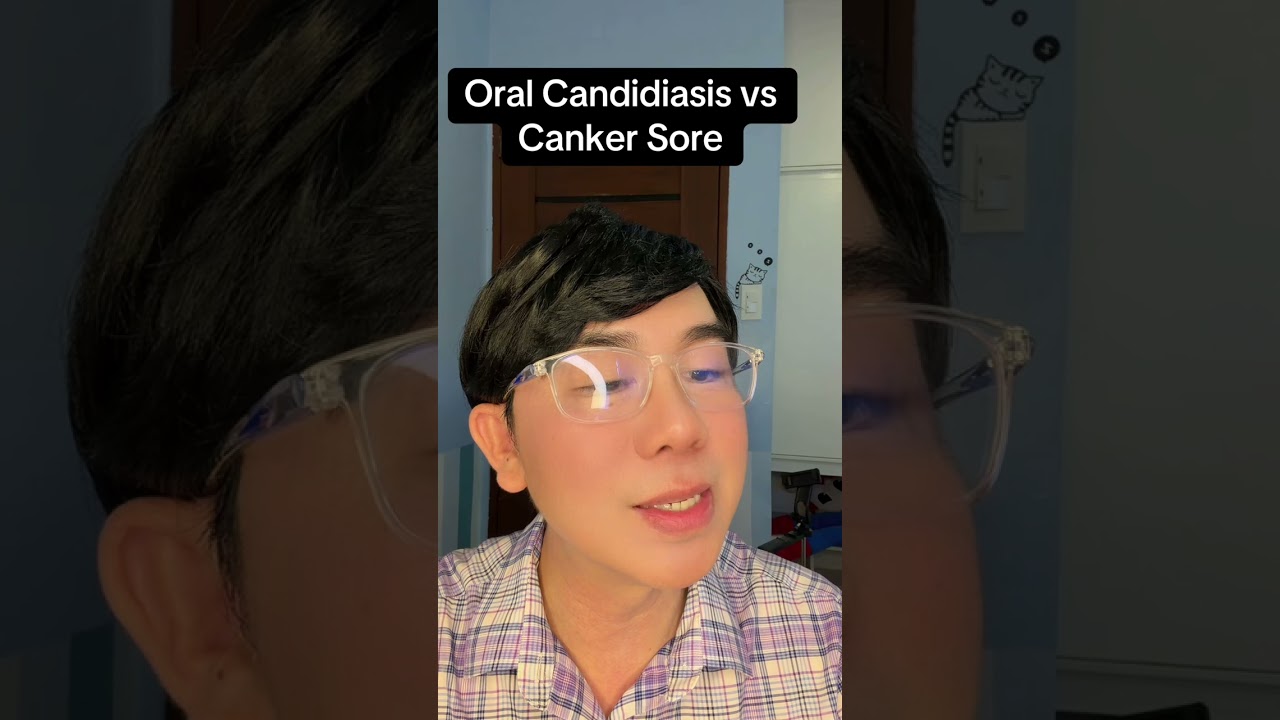 Oral Thrush vs Canker Sore