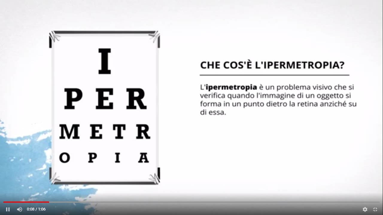 Ipermetropia, che cos'&egrave; e come pu&ograve; essere corretta | Clinica Baviera Italia