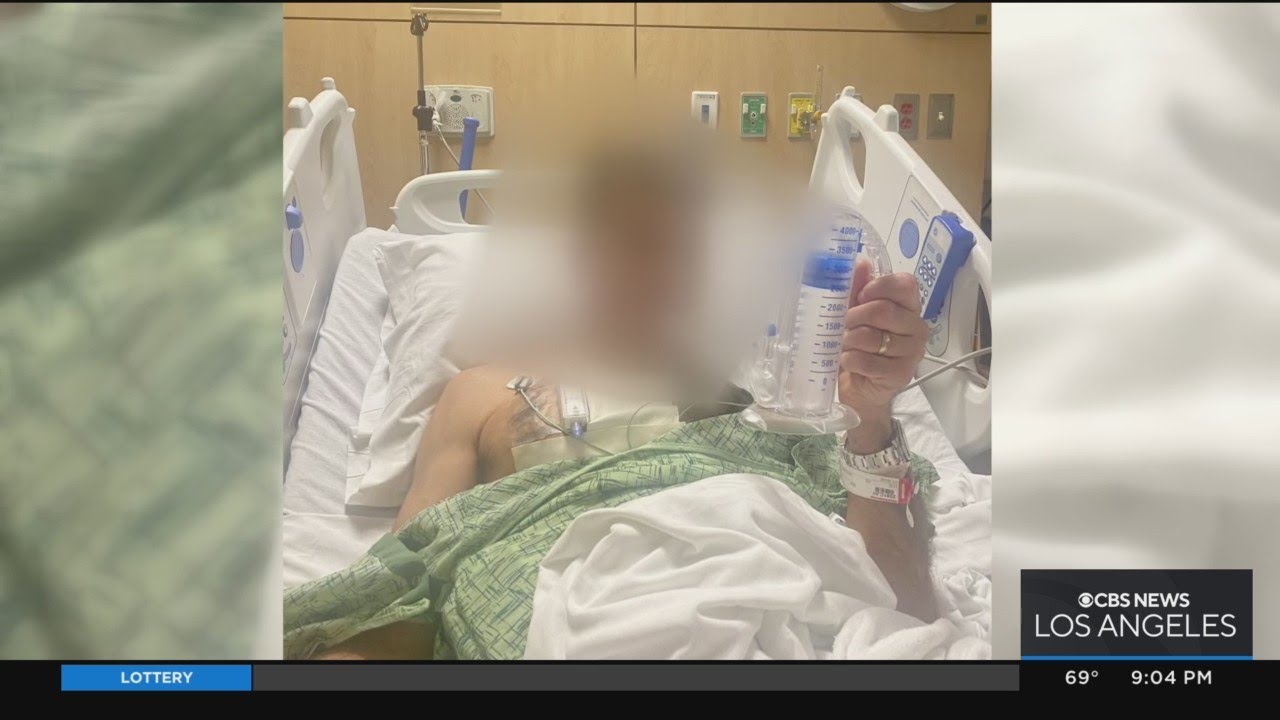 Man recovering after being attacked by homeless men in Studio City