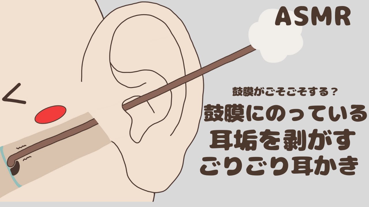 【ASMR】鼓膜にのっている耳垢を剥がすごりごり耳かき｜No Talking｜Deep Ear Cleaning