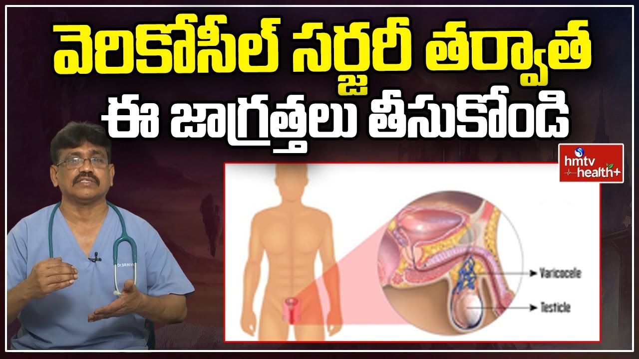 వెరికోసీల్ సర్జరీ తర్వాత ఈ జాగ్రత్తలు తీసుకోండి  | Varicocele Surgery | hmtv Health