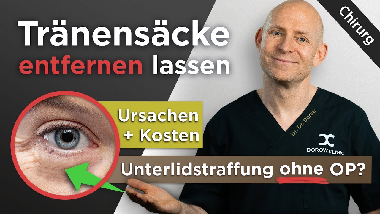 Unterlidstraffung gegen Augenringe | Nie wieder müde Augen