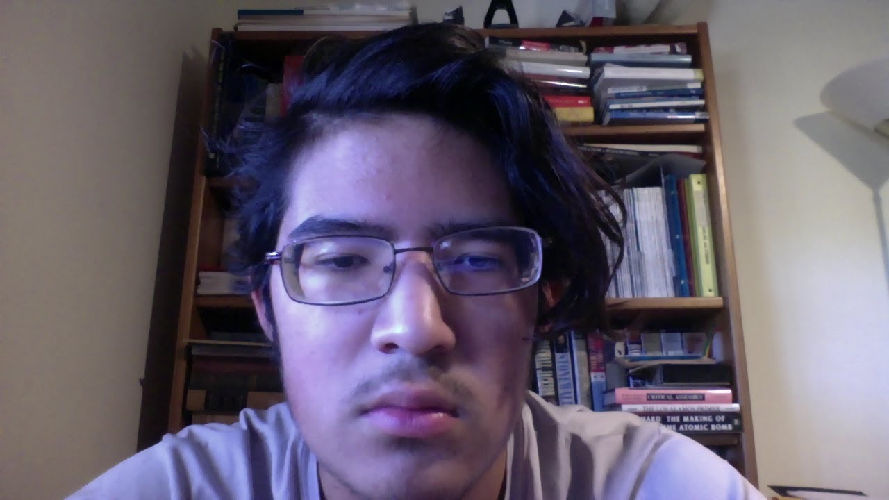 Update on my fractured finger