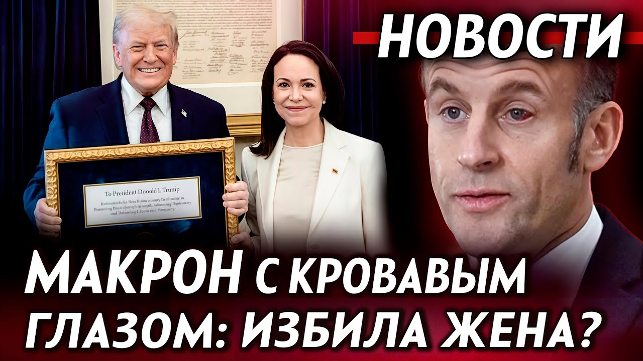 Макрон с кровавым глазом. Трамп получил Нобелевскую премию. Симоньян не верит в порчу