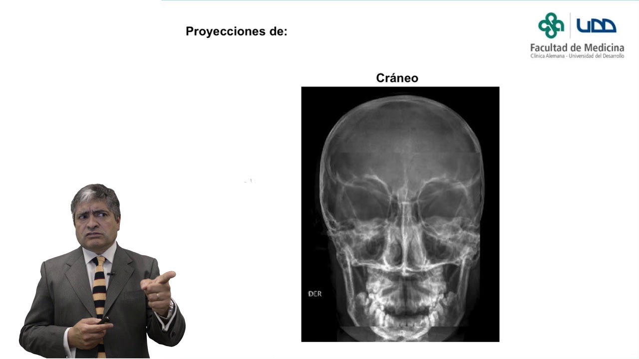 Técnicas Radiológicas Video Clase 15:  Cráneo cara.