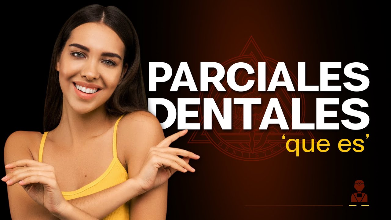 Qu&eacute; son los parciales dentales?