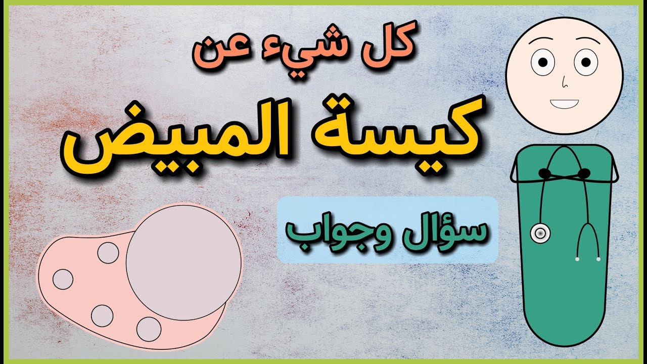 كل شيء عن كيسة المبيض - سؤال وجواب