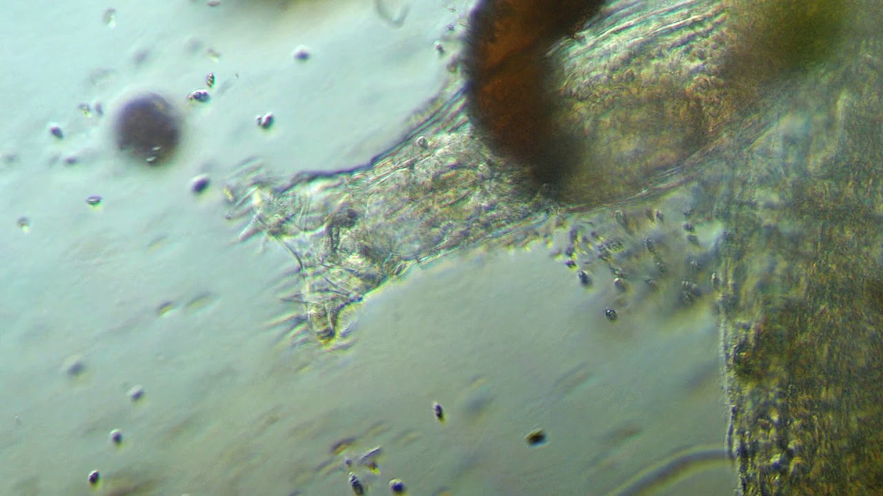 Bdelloid rotifer eating