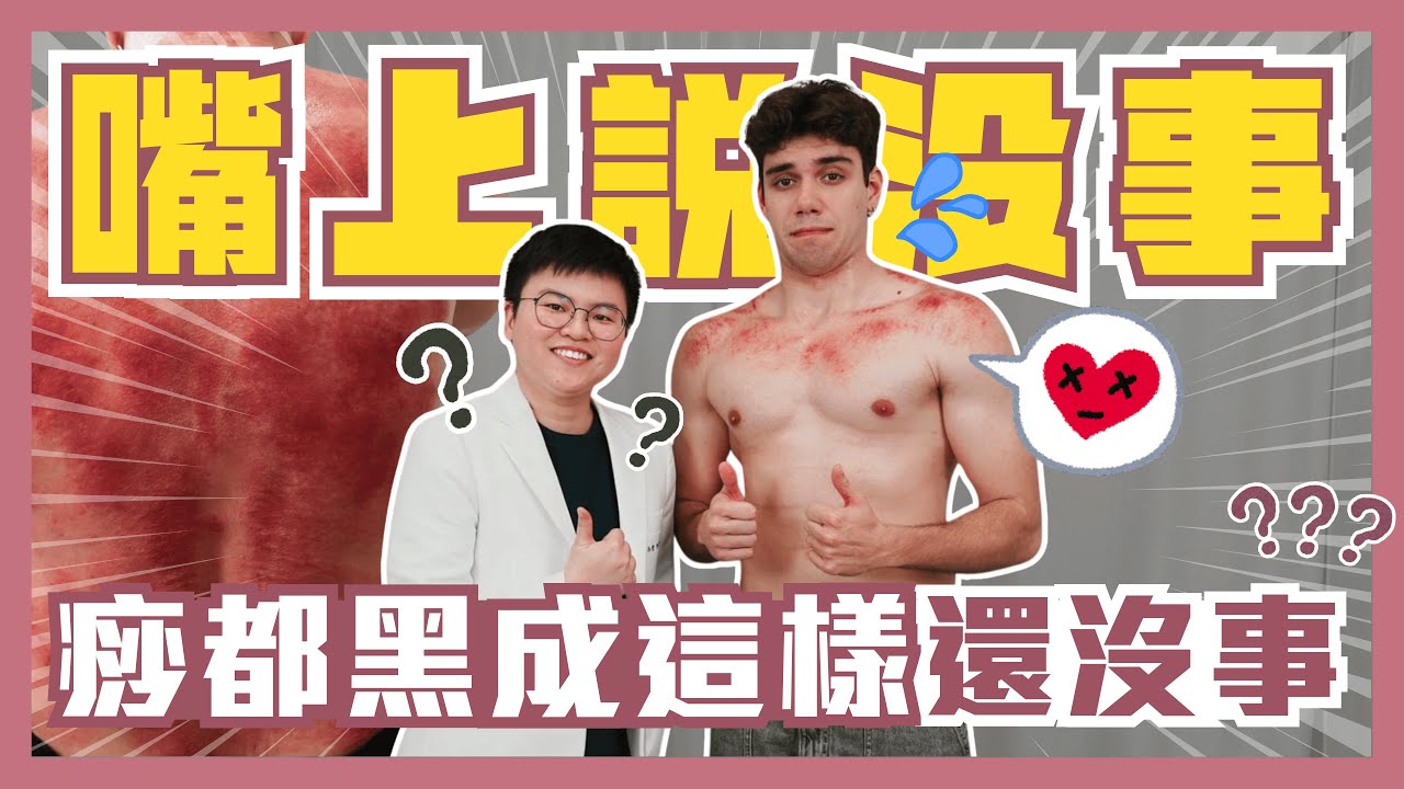 表面硬撐、嘴巴說沒事 身體一刮 滿滿黑痧全招了！