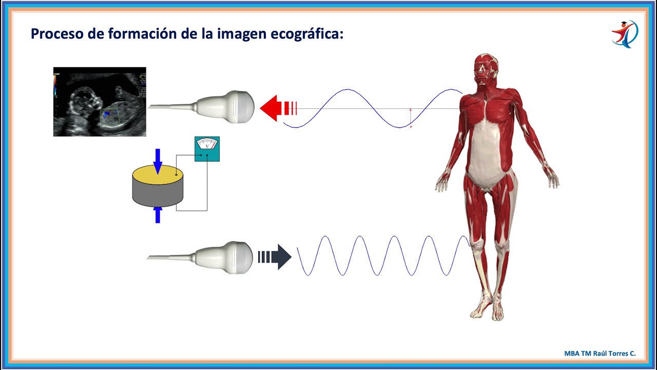 Ecografía, fácil... fundamentos.