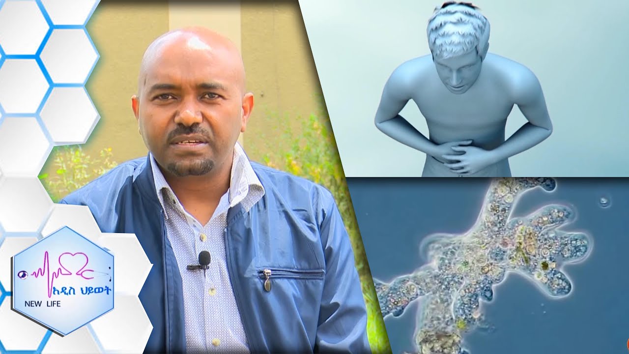 “አሜባ ምንም ጉዳት ሳያደርስ በአንጀት ውስጥ ሊኖር ይችላል…./NEW LIFE EP 360