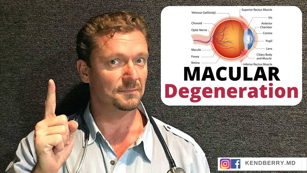 MACULAR Degeneration (Prevent It / Improve It)  2024