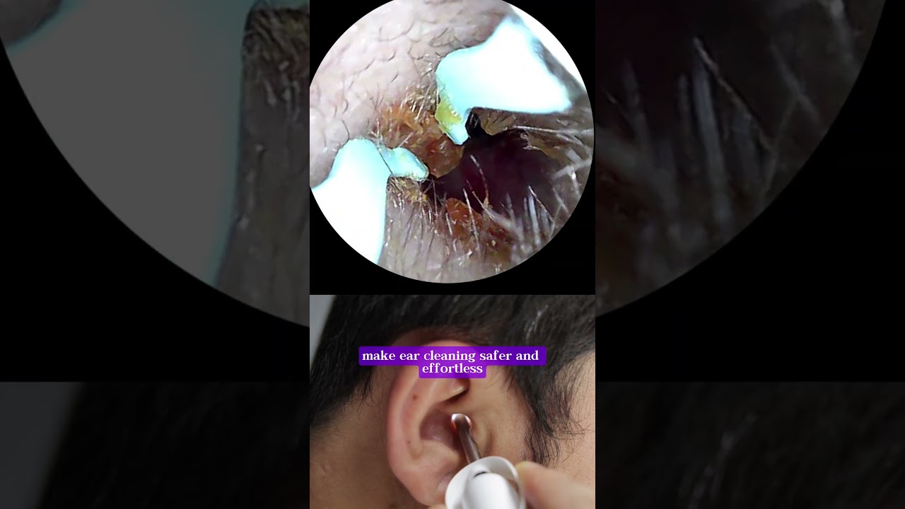 💤 Oddly Satisfying Ear Cleaning ASMR Using Bebird Earsight Plus #earcleaning #asmr #earwax