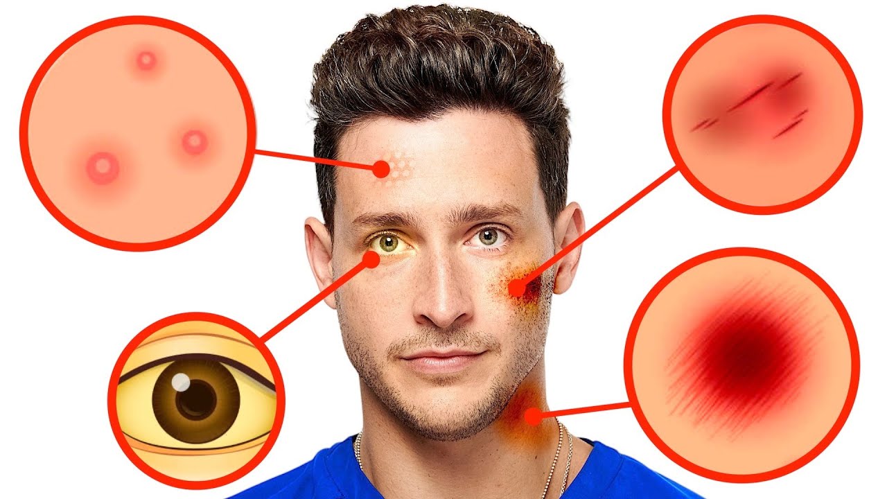 Skin Changes You Shouldn’t Ignore