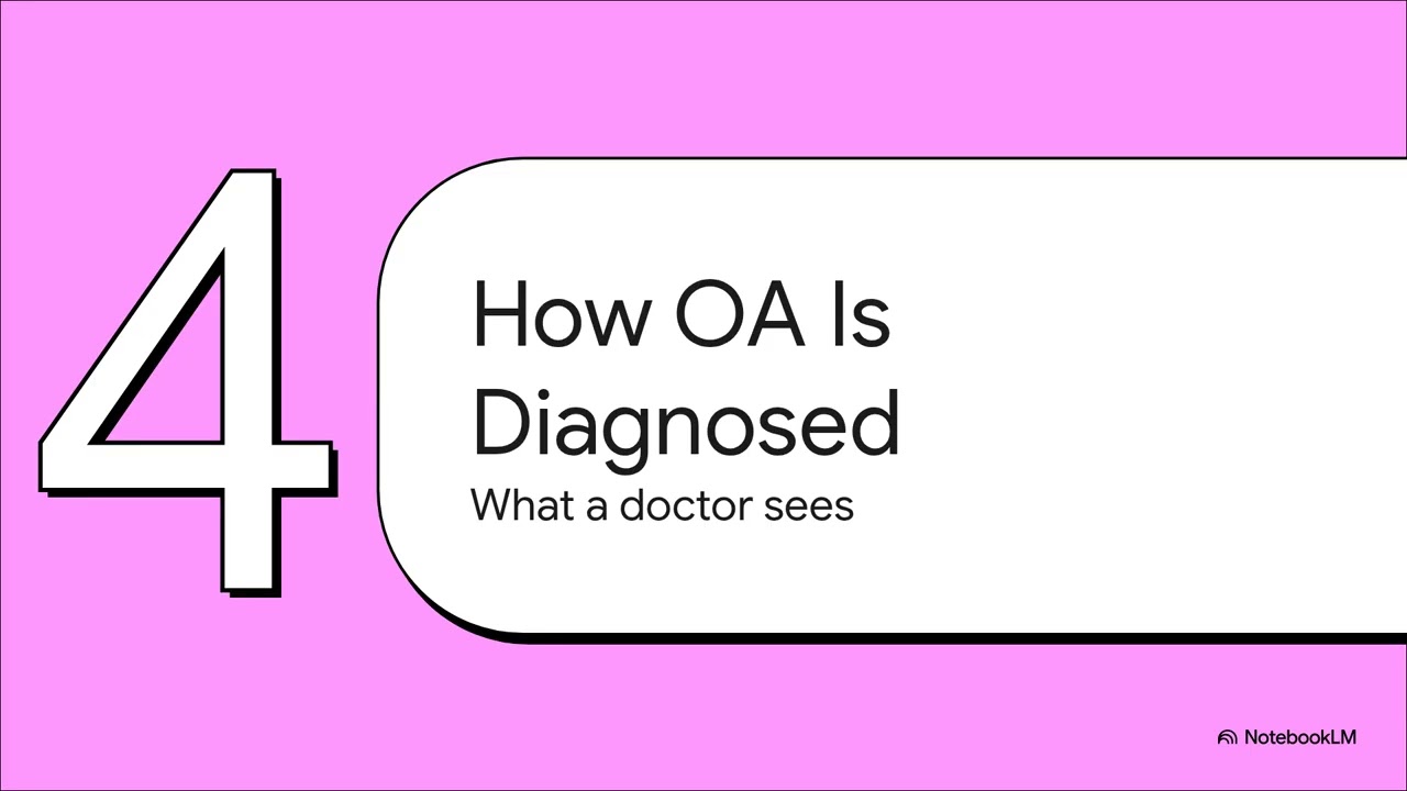 The Explainer Osteoarthritis