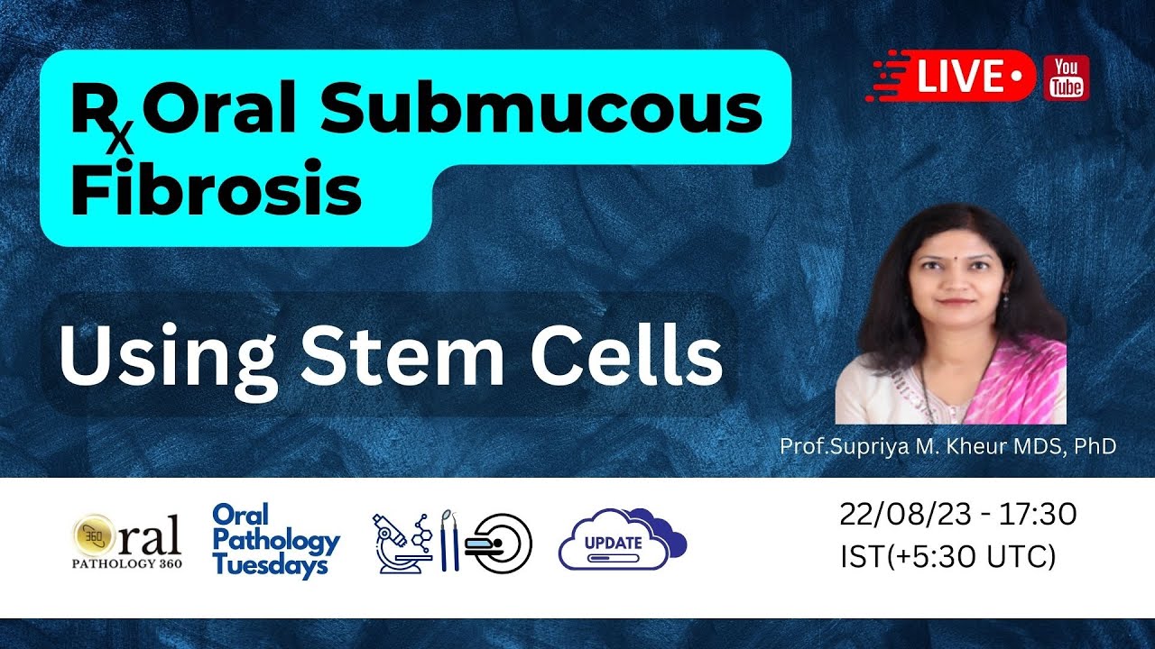 Harnessing the potential of mesenchymal stem cells in the treatment of  Oral Submucous Fibrosis