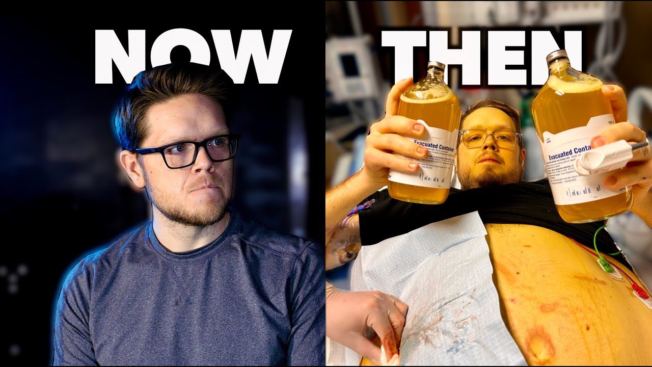HE COULDN'T STOP DRINKING... Even When His Organs Were Failing | Surviver Testimonies (Ep. 3)