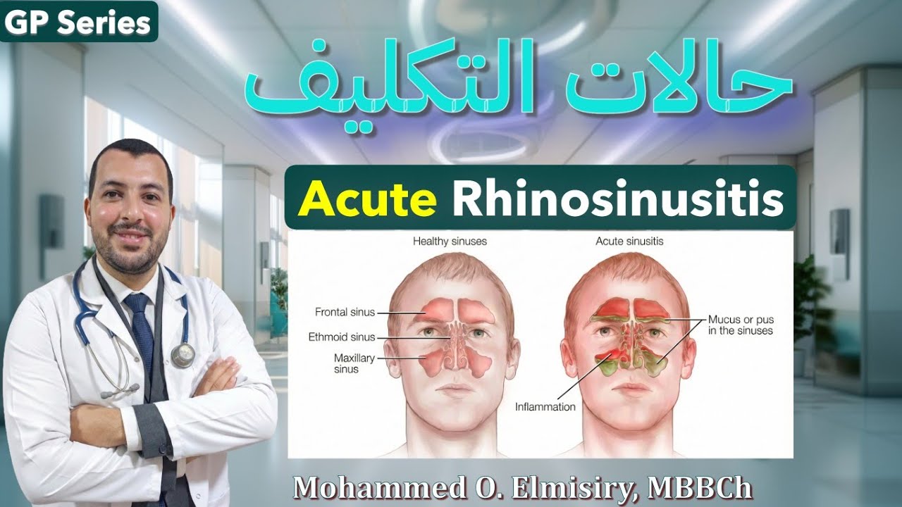 حالات التكليف | Acute Rhinosinusitis approach & EBM management 👃💊