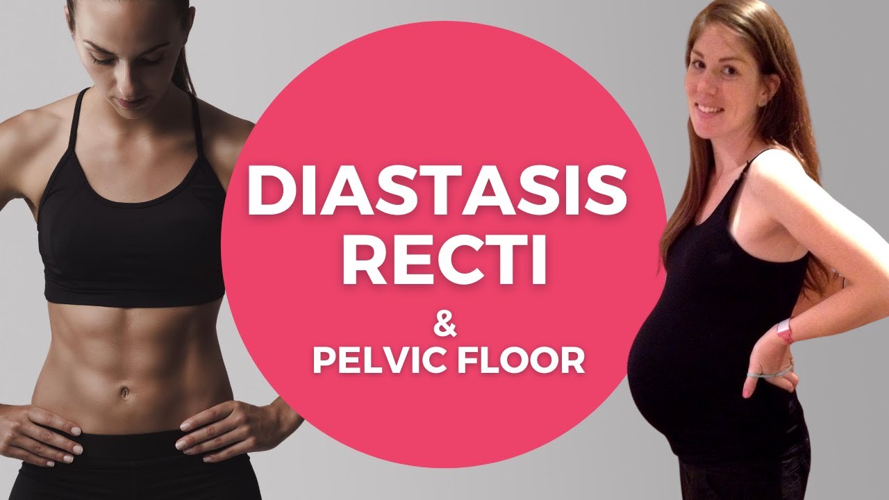 5 Exercises for Diastasis Recti to Close the Gap + Strengthen your Pelvic Floor