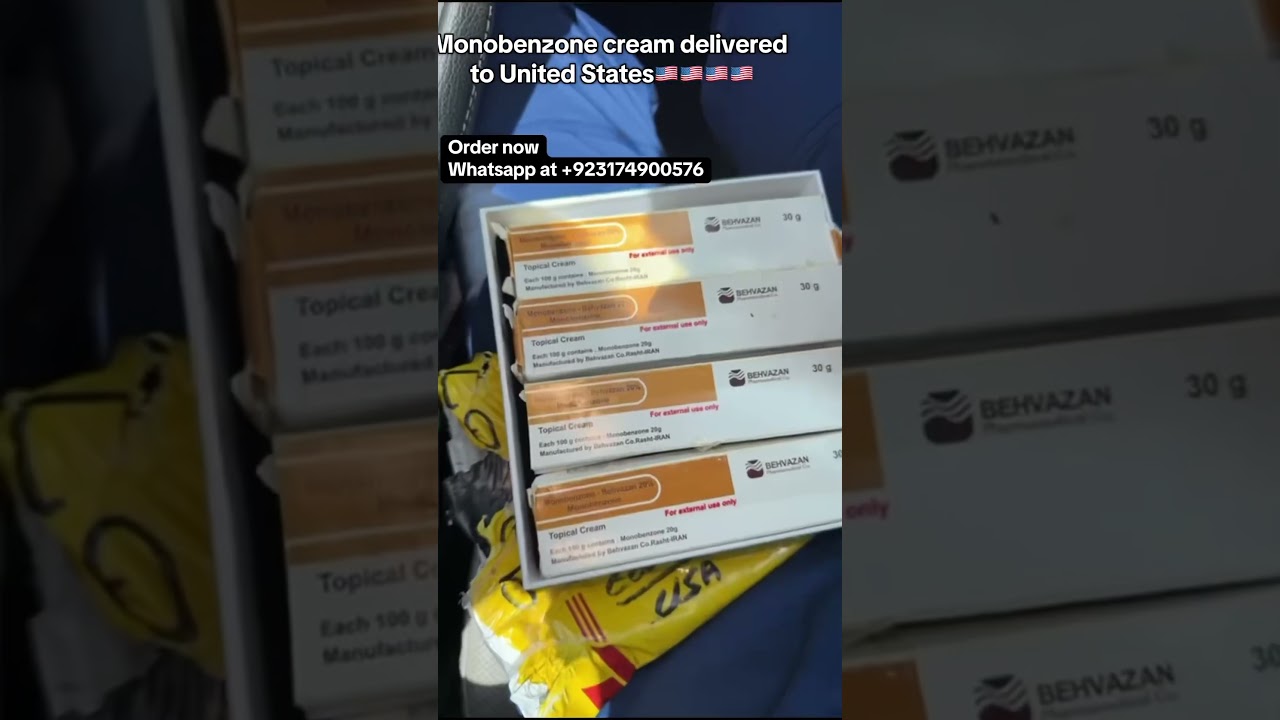 Monobenzone cream is used for full body whitening in vitiligo patients