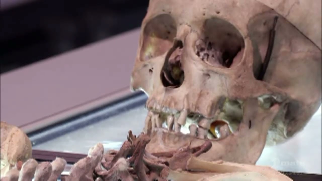 Illegal Victorian Era Human Skeleton - Pawn Stars UK