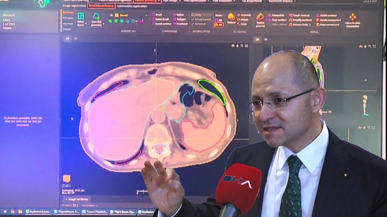 Prostat kanserinin tedavisinde yapay zeka başarısı