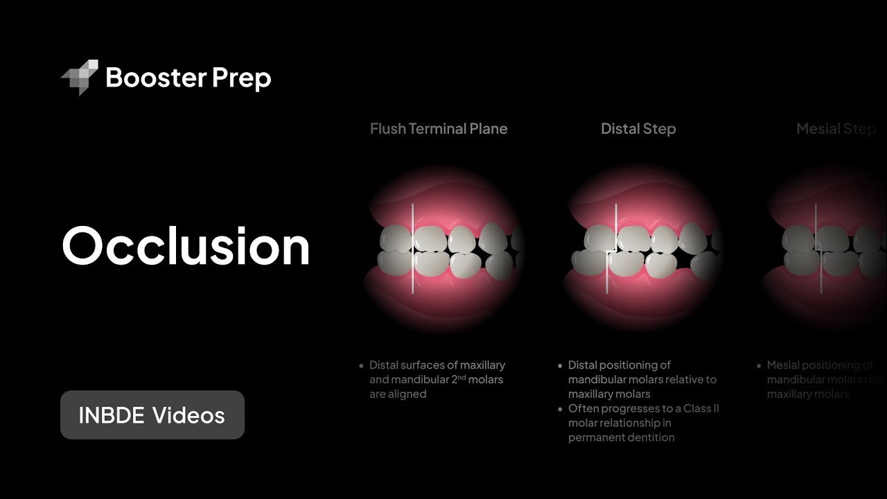 Prosthodontics | Occlusion & Picket Fence | INBDE, NDEB, ADAT
