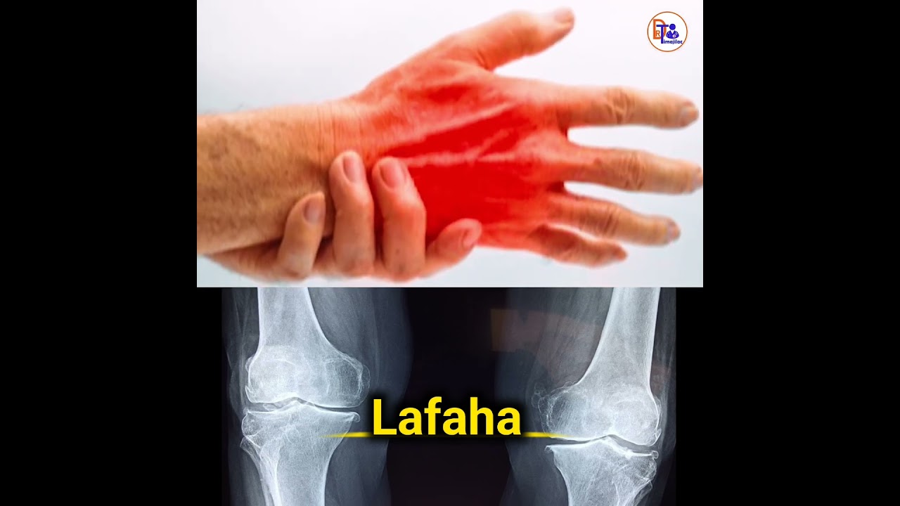 lafa xanuunka