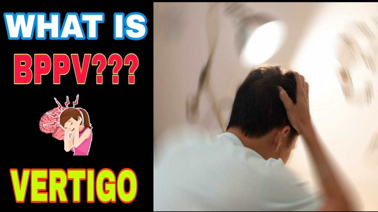 5 Best Exercises for BPPV Vertigo | BPPV Treatment in Hindi | Dizziness Epley Maneuver, Dizziness