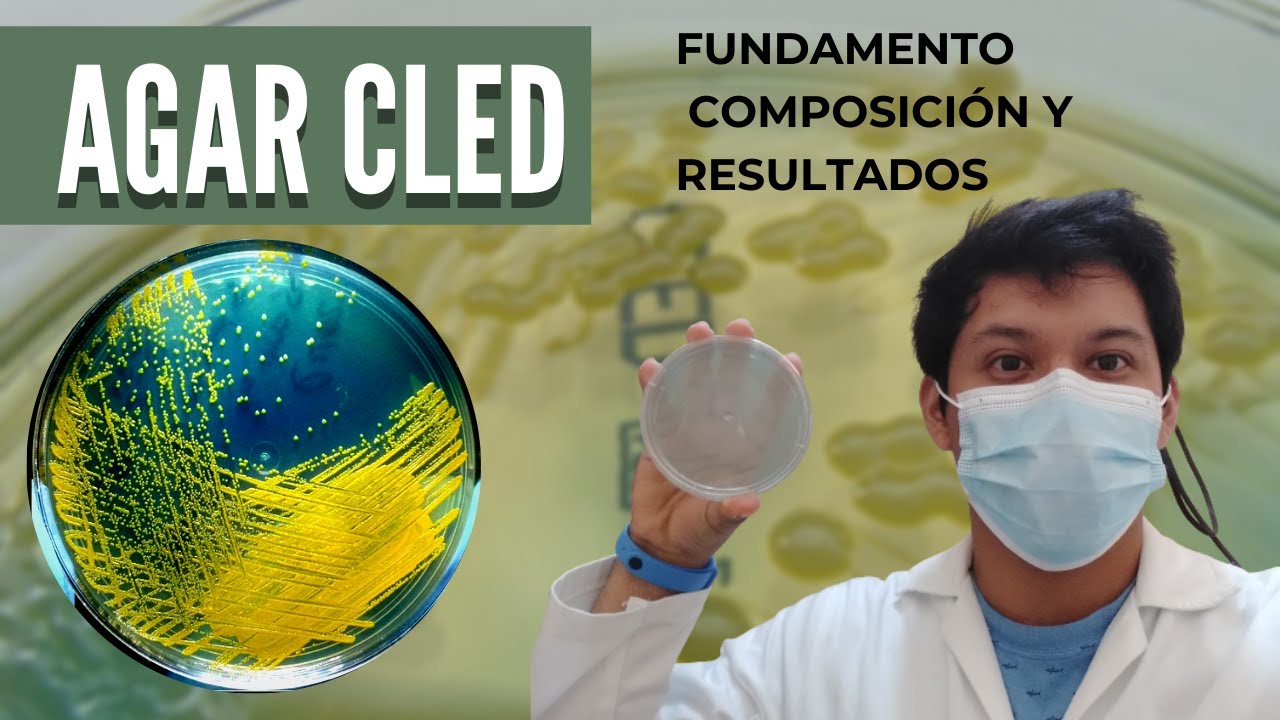 Agar Cled medio de cultivo l CLED AGAR MEDIA URINE  l AGAR CISTINA LACTOSA l AGAR CLED FUNDAMENTO
