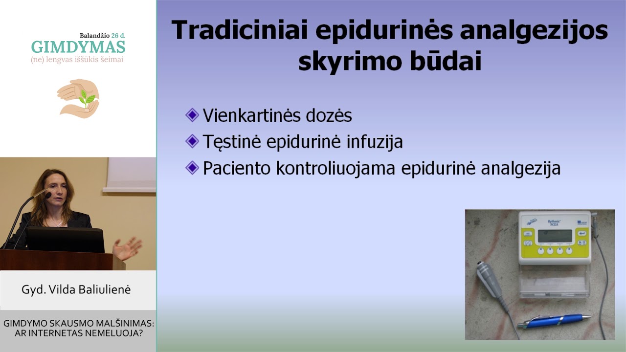 Gimdymo skausmo malšinimas: ar internetas nemeluoja?