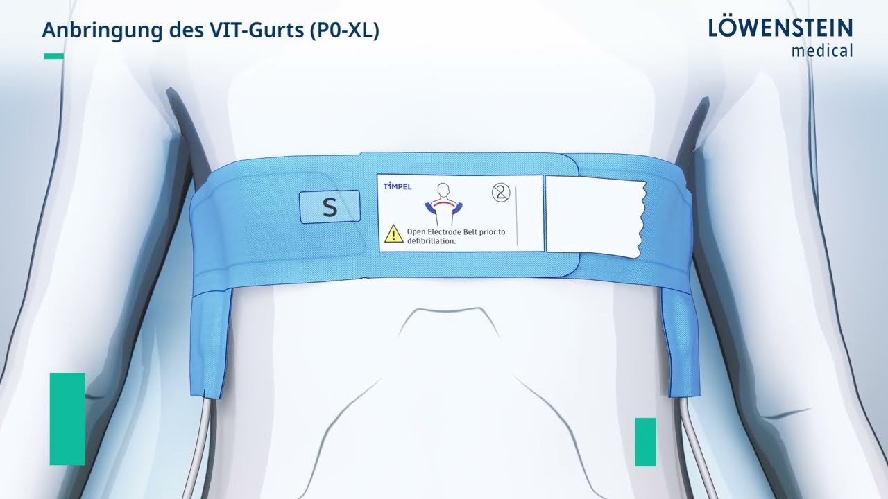 Ventilatorintegrierte Tomografie 3.0 (VIT)