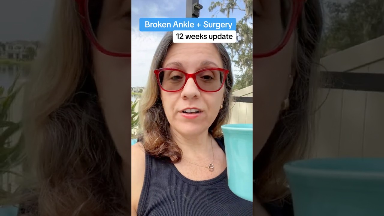 12 Weeks post Orif surgery - Broken Ankle Recovery Update 14 #brokenankle #ankleinjury #brokenankles