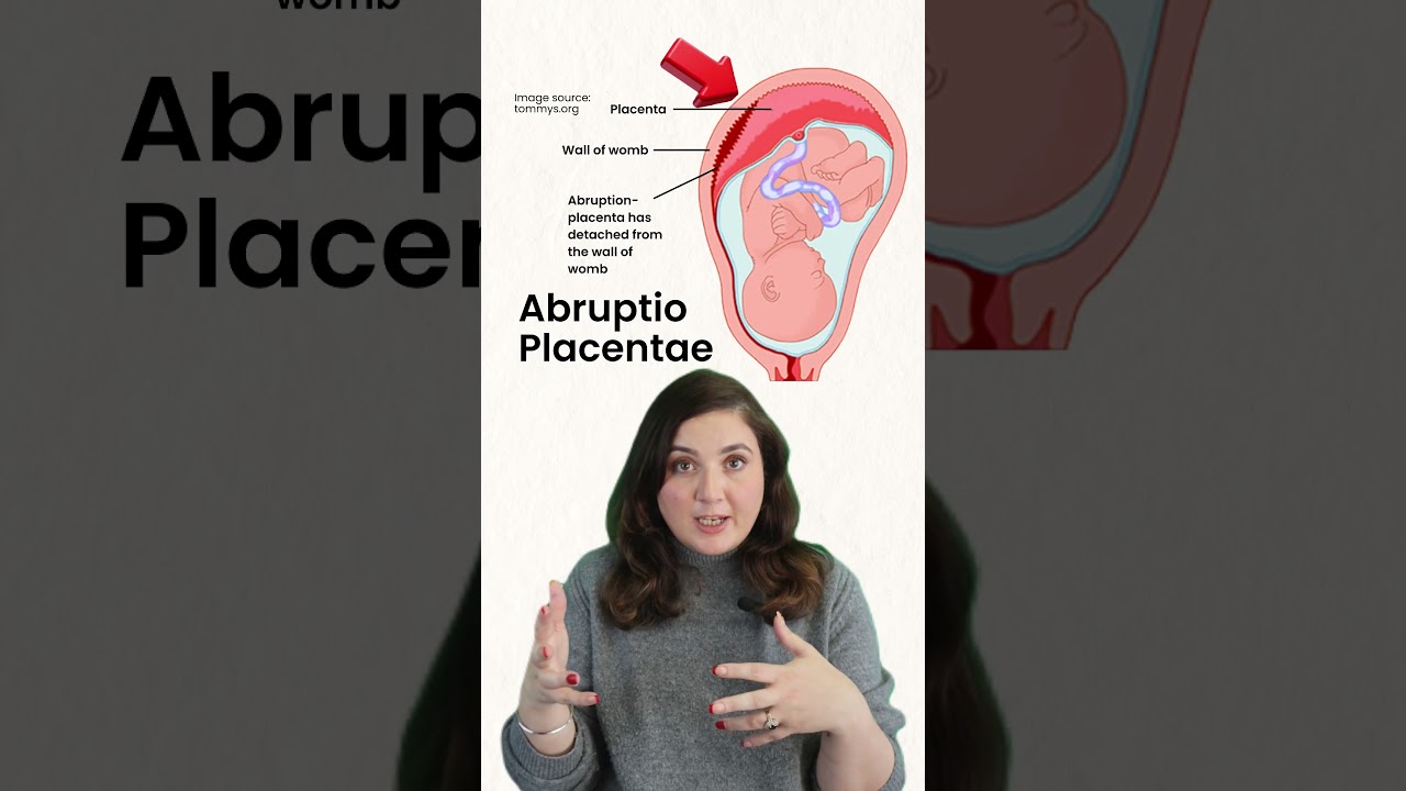 Placenta previa & Abruptio Placentae, Nursing care,  #nclexprep #shorts_video #pregnancycare #desi