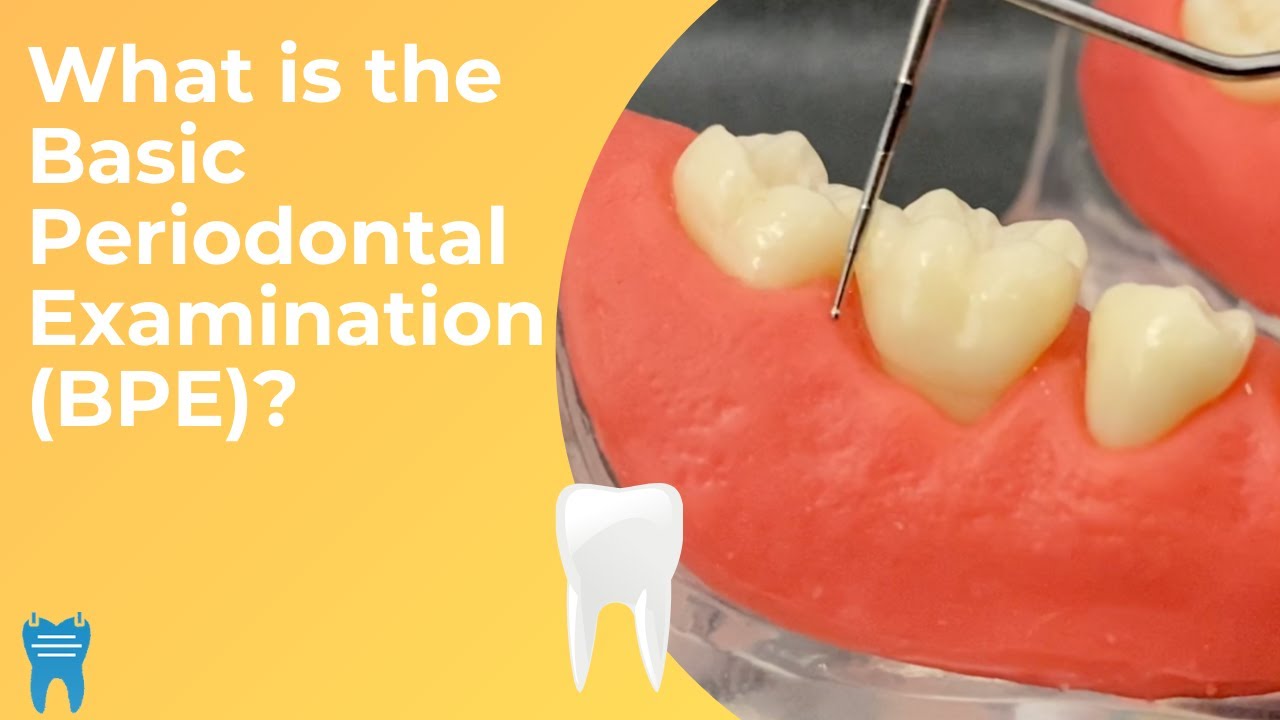 Basic Periodontal Examination (BPE) | What, Why and How?