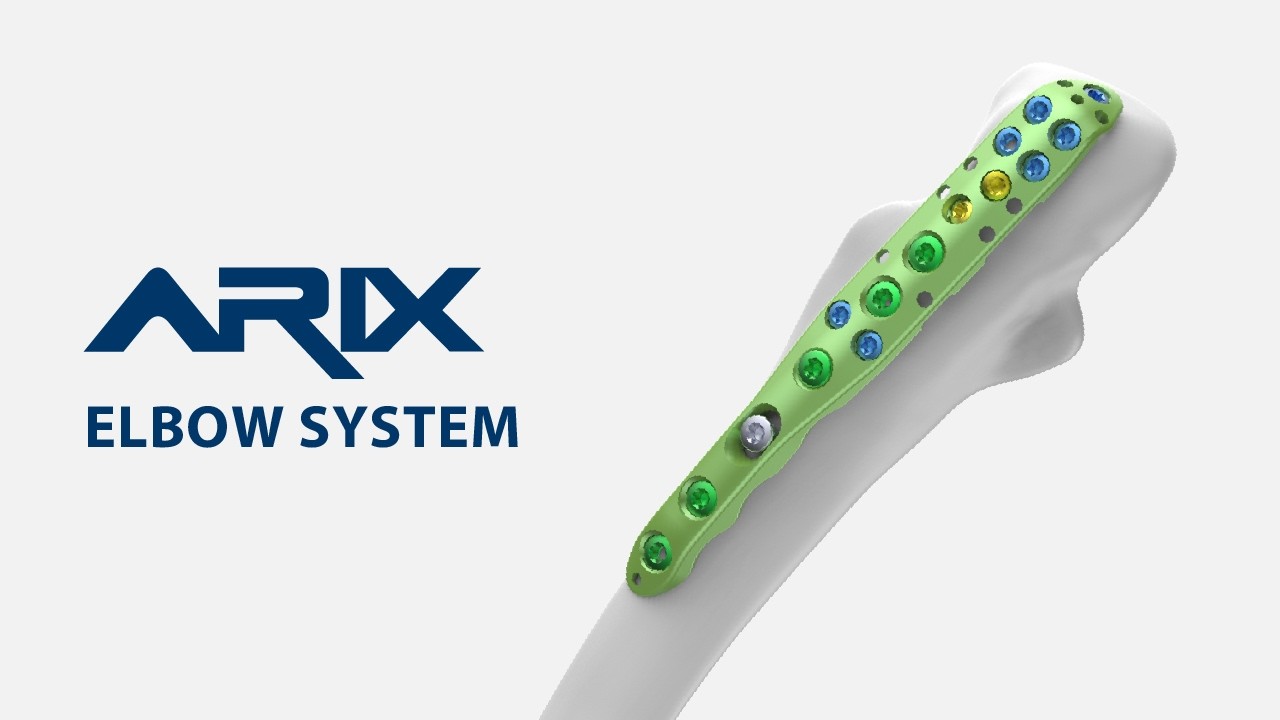 [ARIX OS] ARIX Elbow - Olecranon Surgical Guide