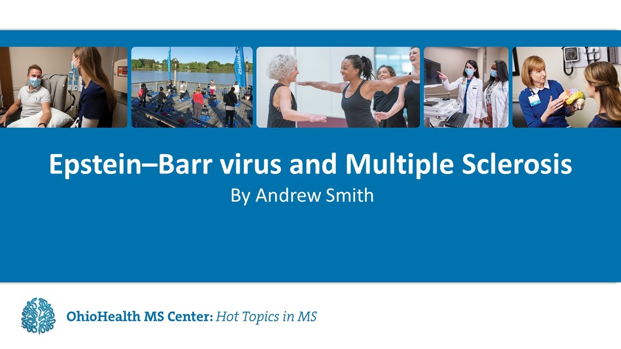 Epstein Barr Virus and MS