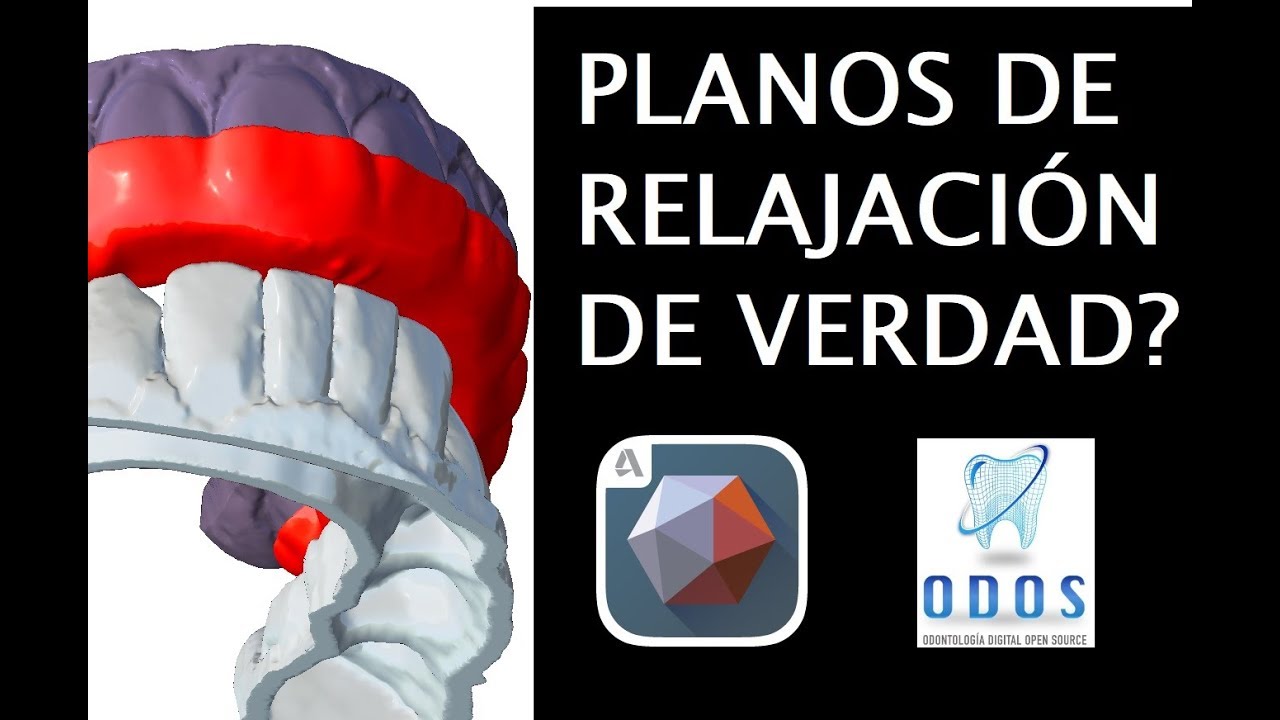 No sabes hacer un plano de relajación digital?. tutorial 15 meshmixer