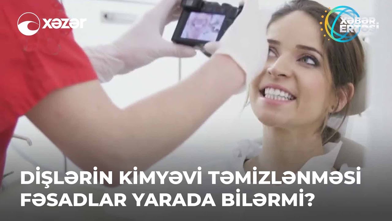 Dişlərin Kimyəvi Təmizlənməsi Fəsadlar Yarada Bilərmi?