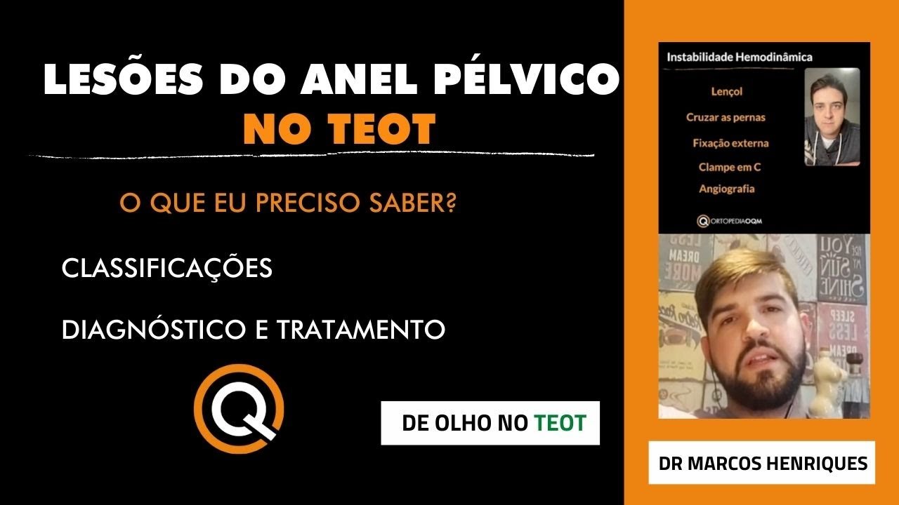 Lesões do Anel Pélvico no TEOT! Live pra prova da SBOT c/ Dr Marcos Henriques ! OrtopediaOQM
