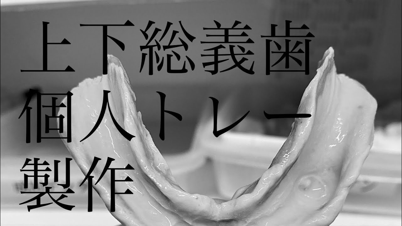 上下総義歯個人トレー製作