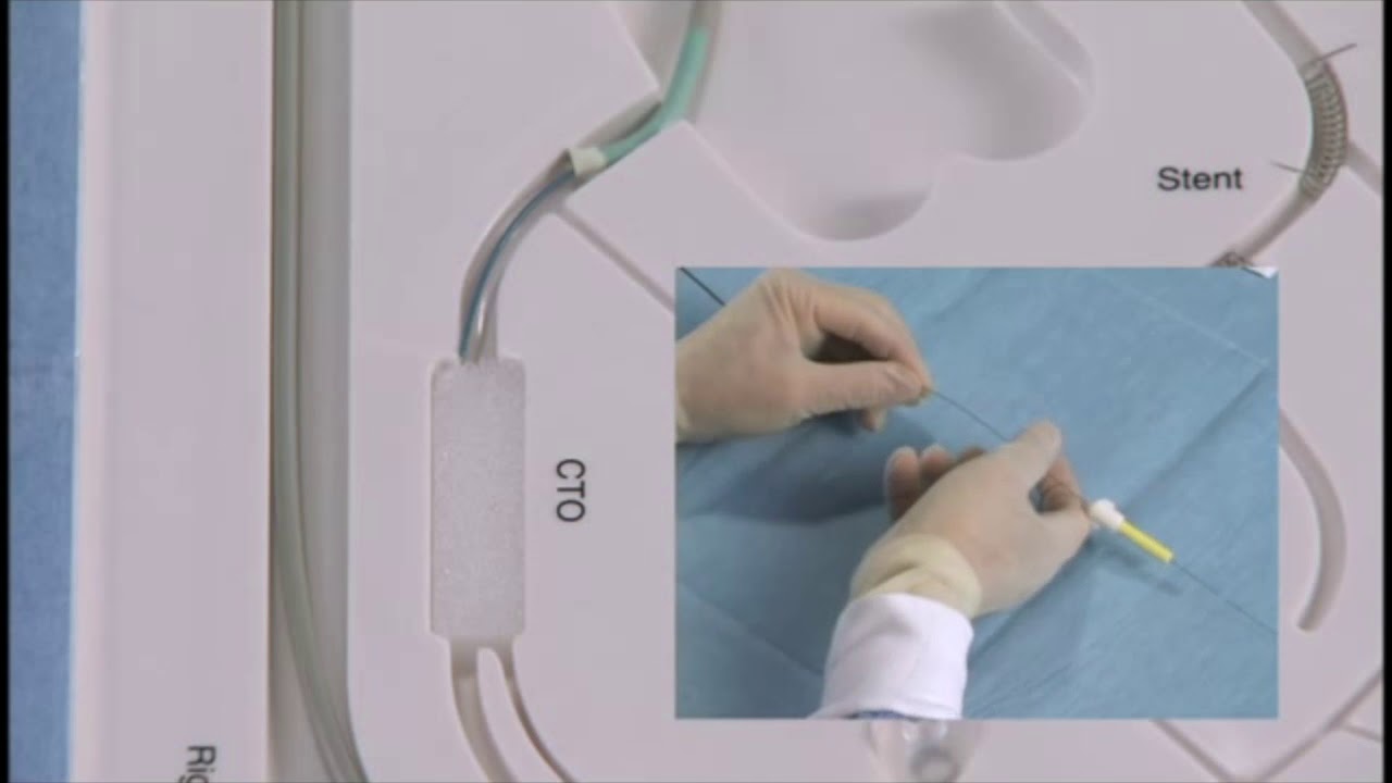 Angioplasty technique: an antegrade approach for CTO (+English subtitle)