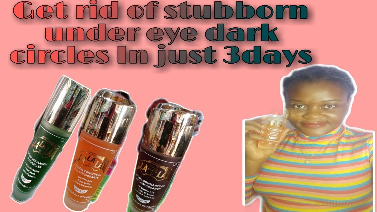 Get rid of stubborn under eye dark circles In just 3days/ lalala toning lotion/keeping up with Mimi