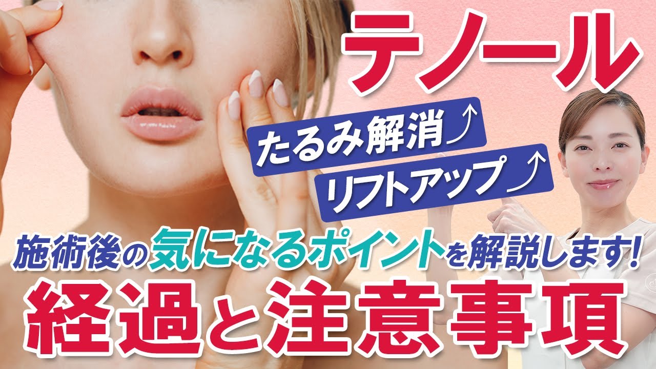 【ナースが解説！】テノールの施術後の経過と注意事項についてお教えします！【美容皮膚科】