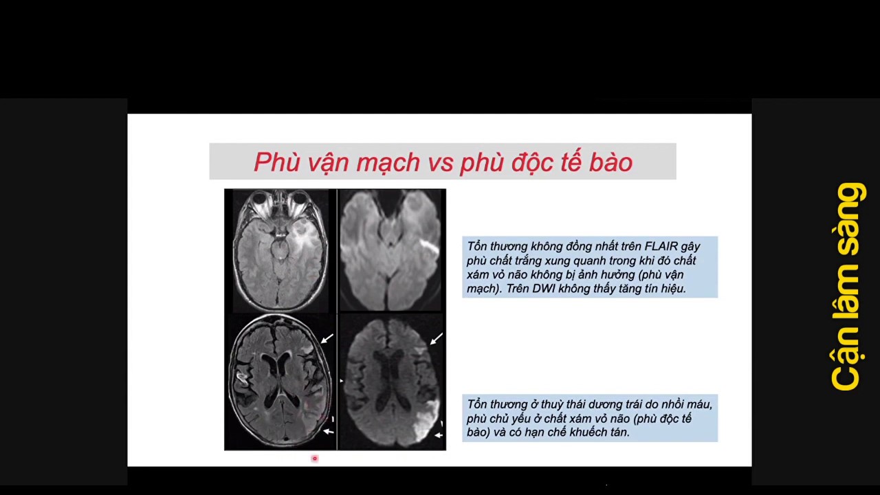MRI U não | TS. Nguyễn Thanh Thảo