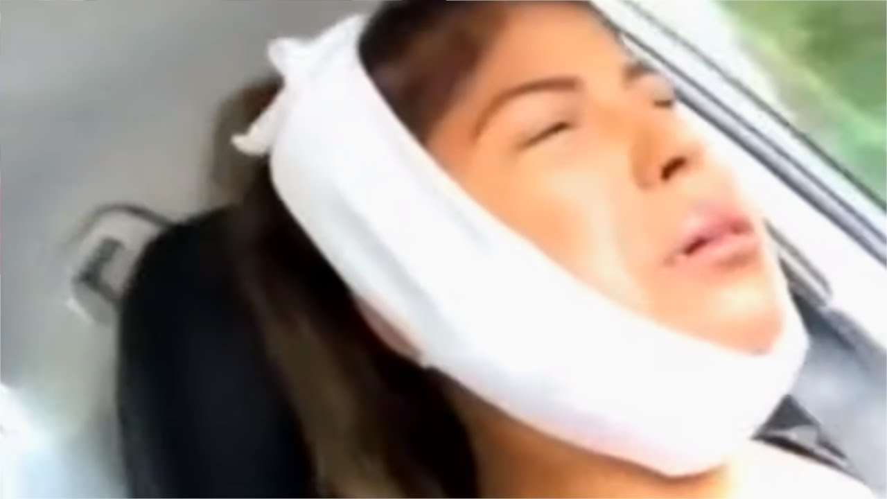Woman cries for hilarious reason after getting wisdom teeth removed