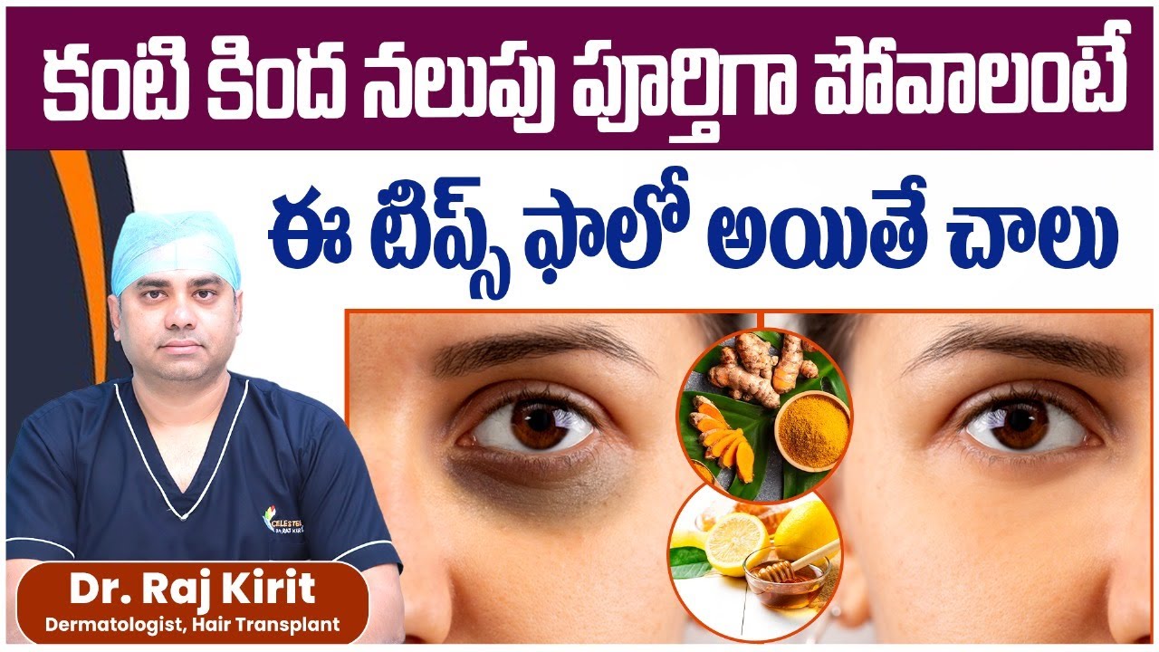 కళ్ళ కింద మచ్చలు || Reasons for Dark Circles Under Eyes in Telugu || Celestee Skin And Hair Clinic