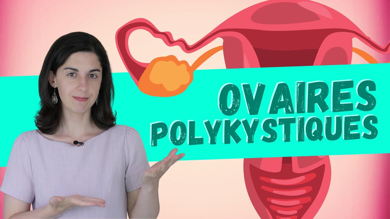 Syndrome des ovaires Polykystiques - Comment le contrôler avec l'alimentation