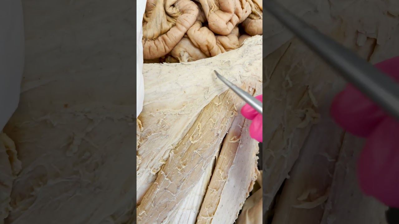 An Important Feature of the Femoral Artery